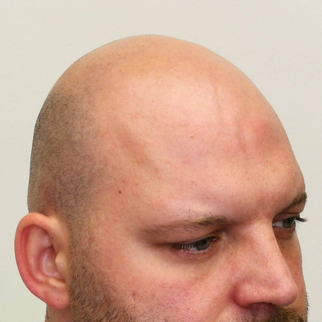 Előtte