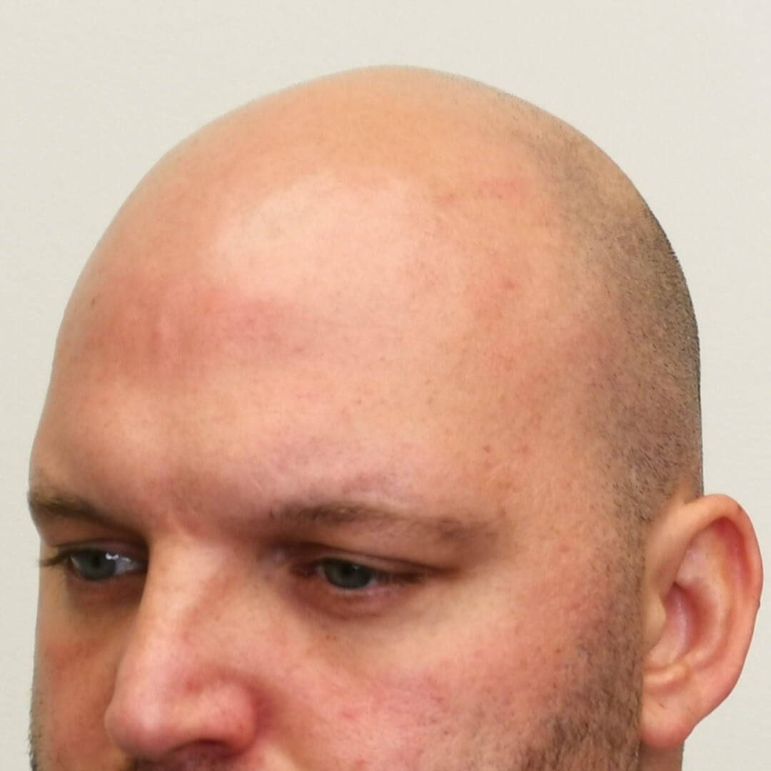 Előtte